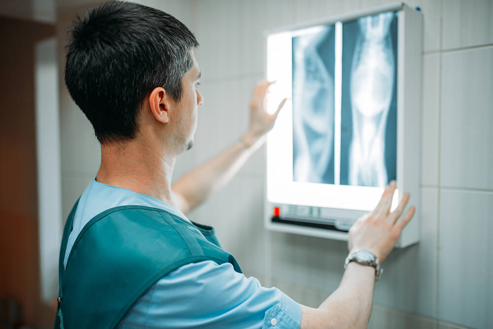 radiografia-abdominal